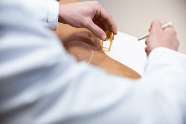 4-avantages-a-choisir-lepilation-laser-dans-un-centre-medical-a-Lyon-Dermo-Laser.png